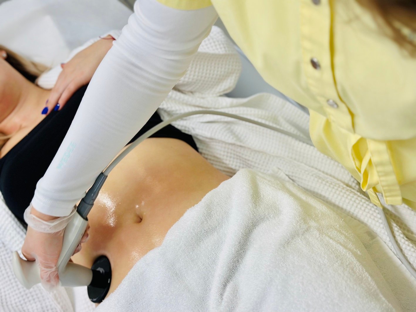 Как и защо избрахме NuEra Tight да замести VelaShape III